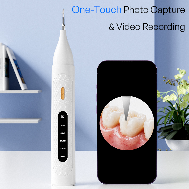 Zichtbare Ultrasone Tandenrein - Teeth Whitening Video recensie en prijs