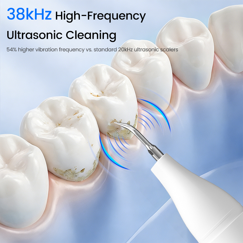 Zichtbare Ultrasone Tandenrein - Teeth Whitening Video recensie en prijs