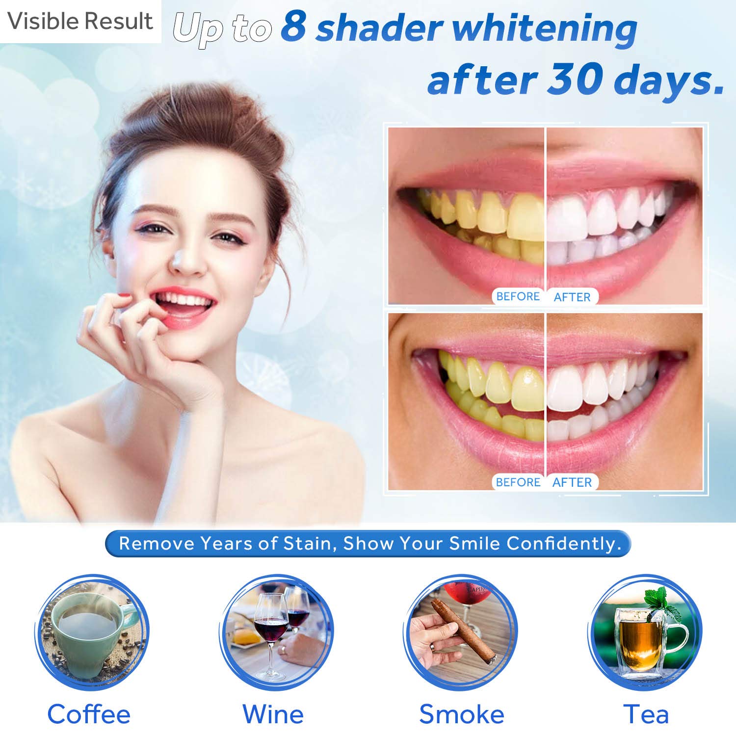 Tanden Whitening Gel Refill Sp - Teeth Whitening Q&M recensie en prijs