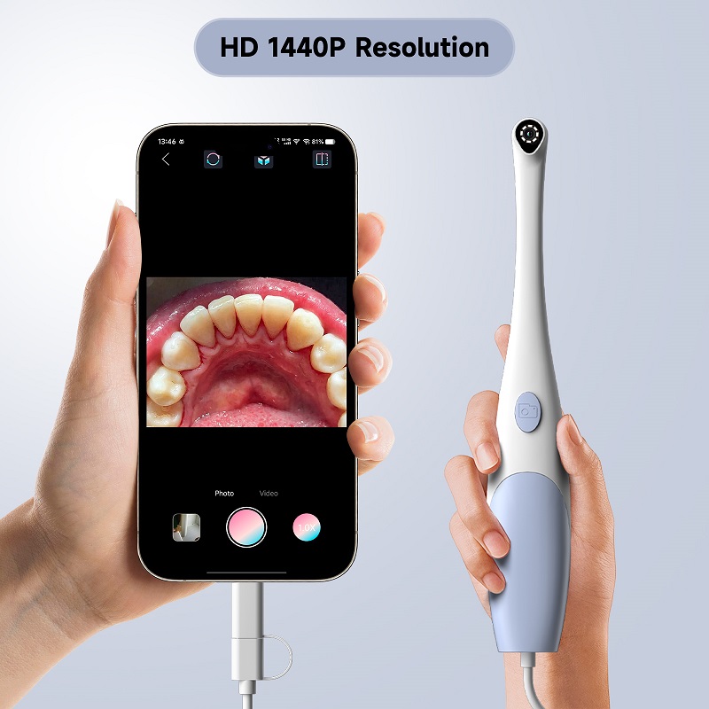 Orale Endoscoop Camera 1440P F - Teeth Whitening Video recensie en prijs