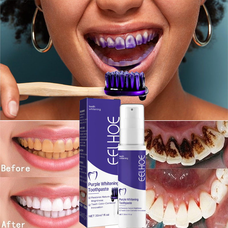 1 Stuks Tanden Reinigen Tandpa - Teeth Whitening In Korea recensie en prijs