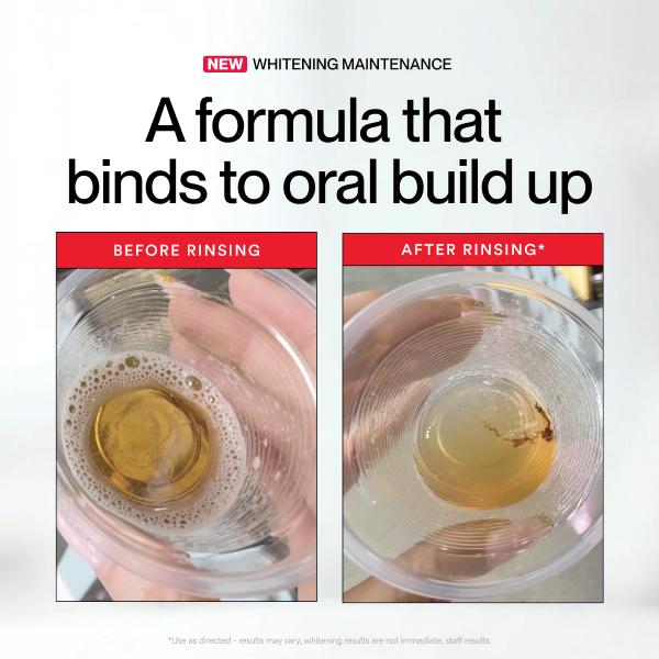 Hismile ID Whitening Stain Mon - Teeth Whitening Products recensie en prijs
