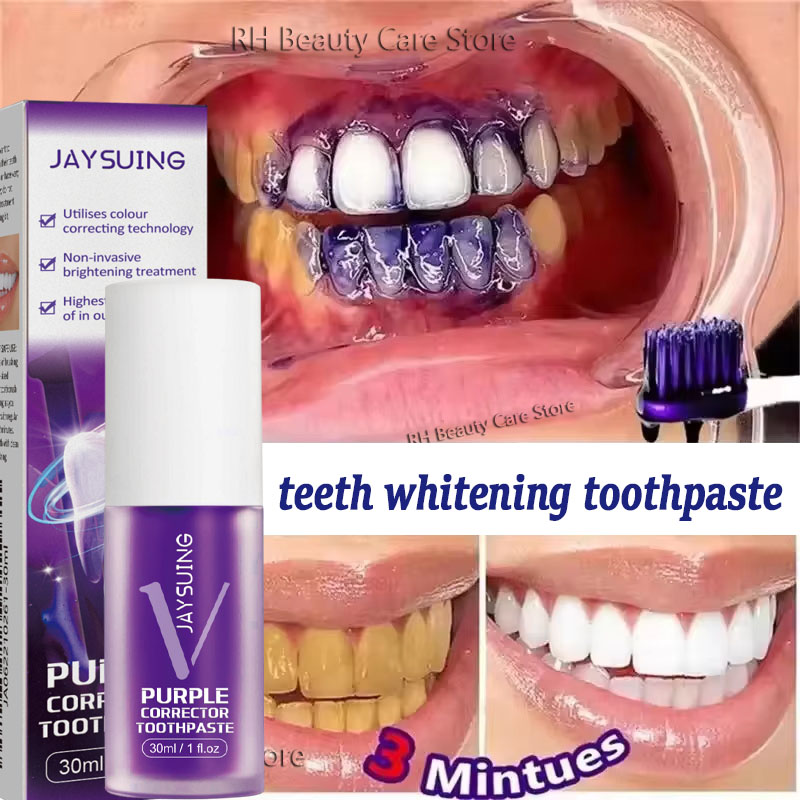 Tandenreiniging Whitening Tand - Teeth Whitening In Korea recensie en prijs