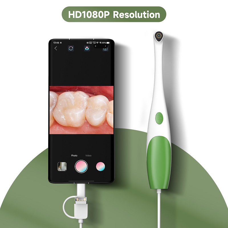 TYPE-C Orale Endoscoop Handhel - Teeth Whitening Video recensie en prijs