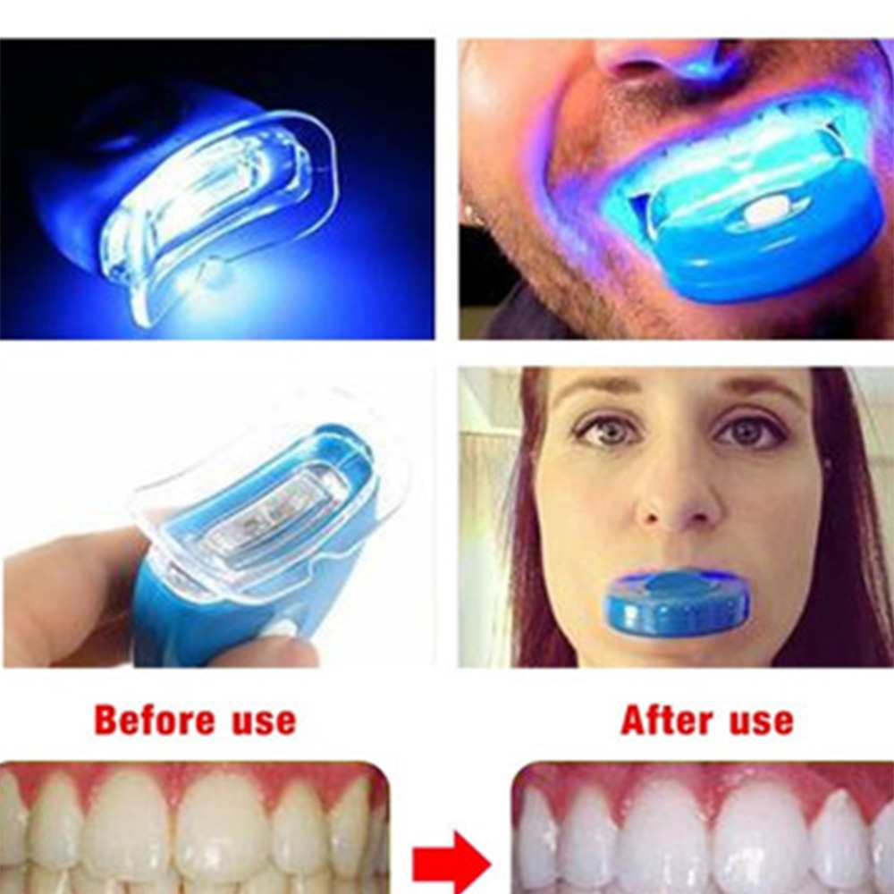 Nieuwe Blauwe Led Tanden Bleke - Teeth Whitening Video recensie en prijs