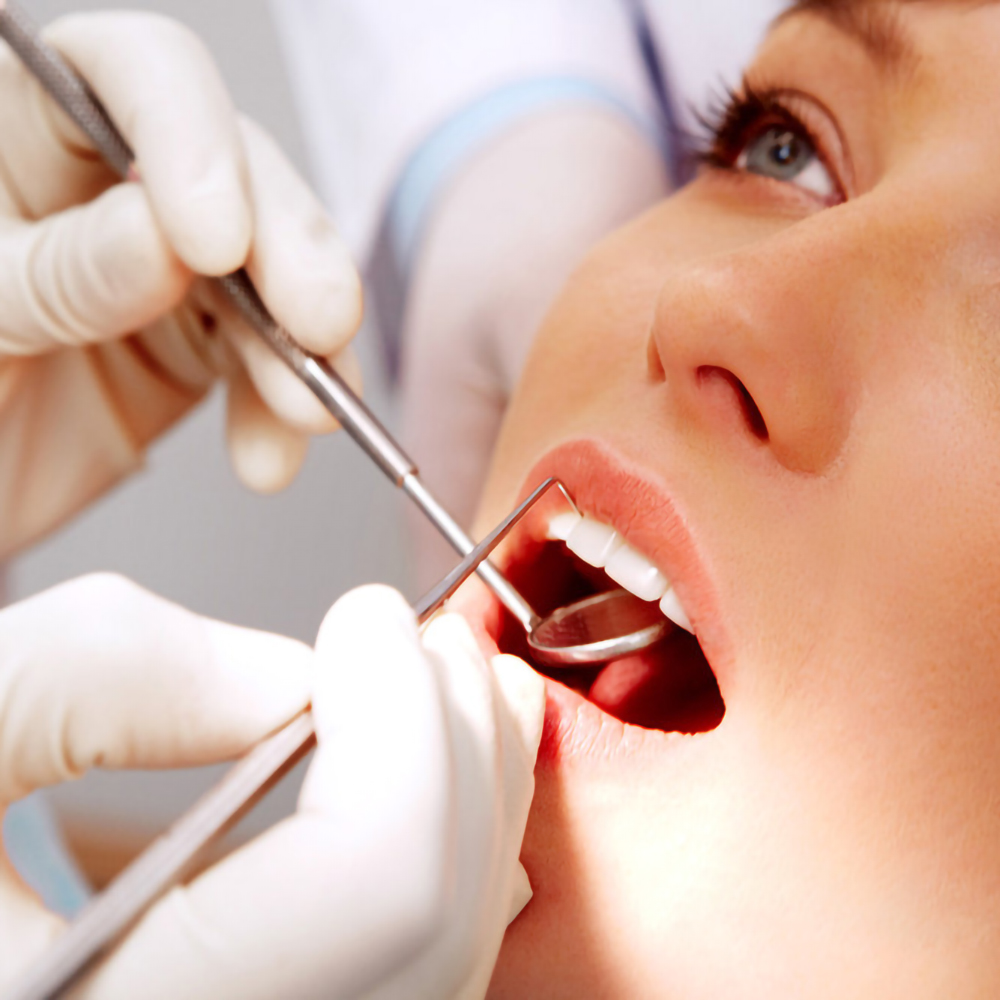 5 stks Rvs Tandheelkundige Mon - Teeth Whitening Products recensie en prijs