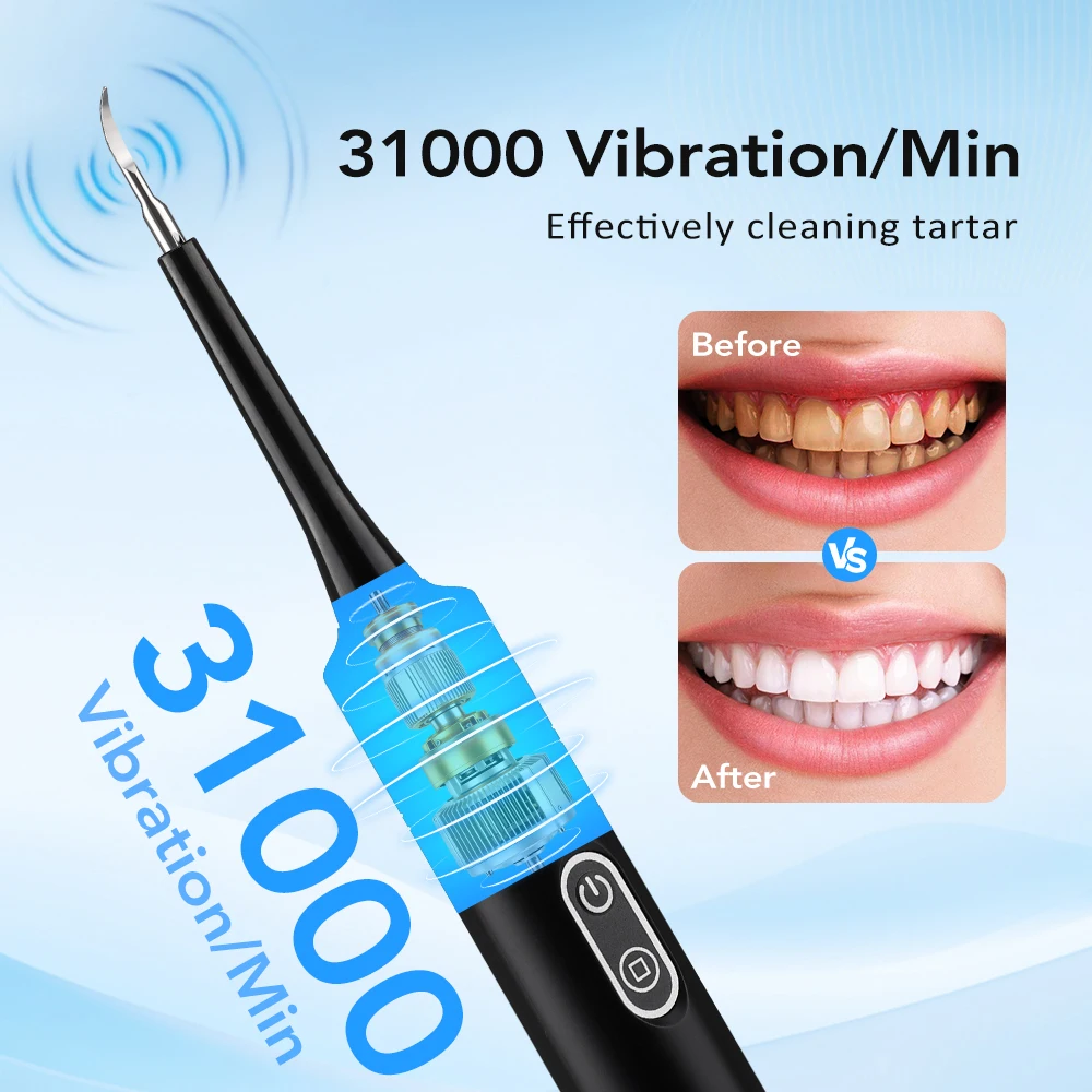 Elektrische sonische vibratie  - Teeth Whitening Products recensie en prijs